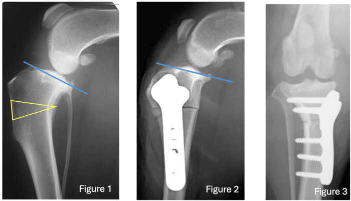 Cranial Closing Wedge Ostectomy (CCWO)