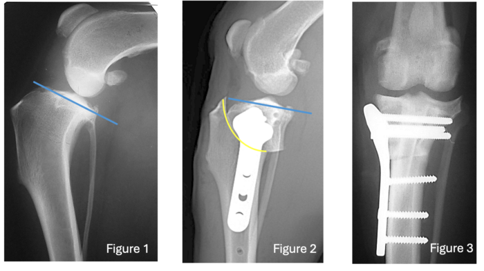 Tibial Plateau Levelling Osteotomy (TPLO)