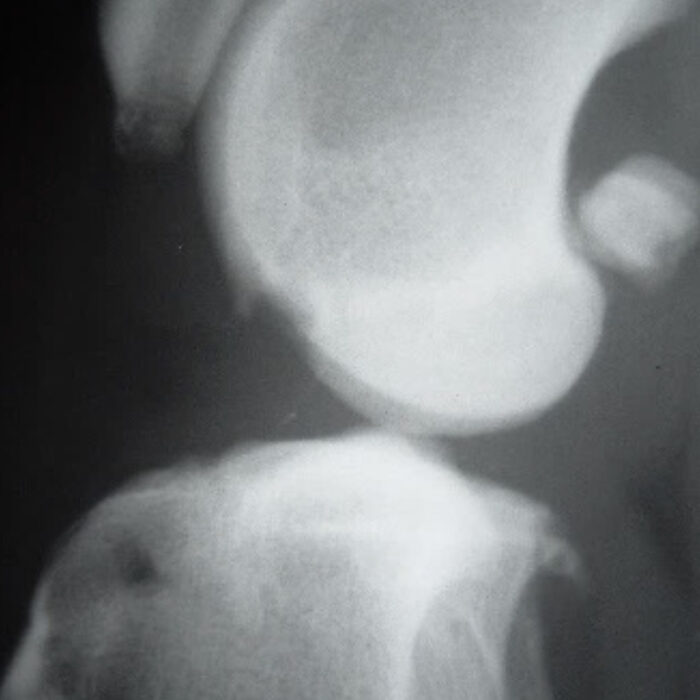 Canine Cruciate Ligament Rupture