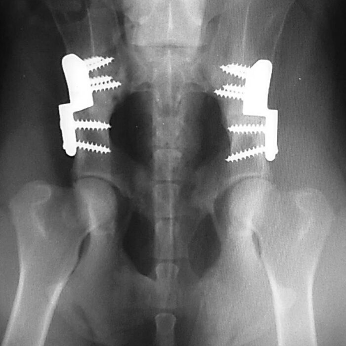 What is Hip Dysplasia?