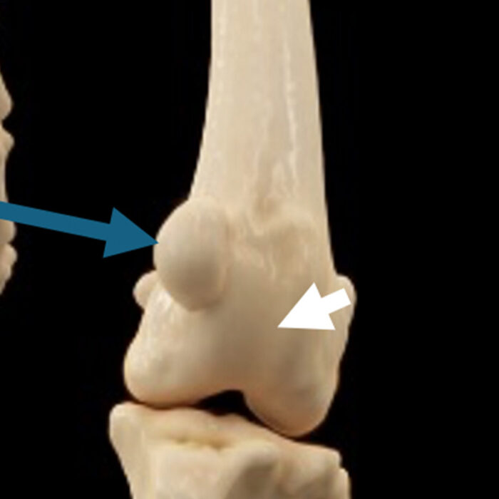 Patellar luxation