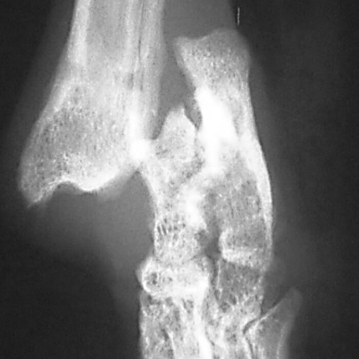 Fractures and dislocations
